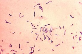 Corynebacterium diphtheriae