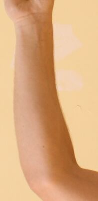 Forearm2.jpg