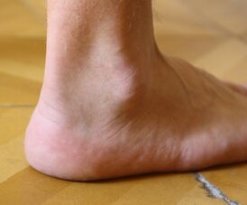 Правый голеностопный сустав, вид сбоку.