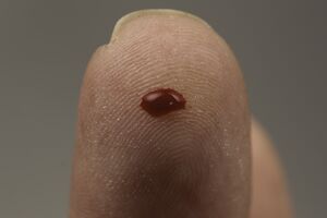 Blood Test (15575812743).jpg