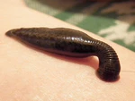 Sucking leech.jpg
