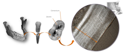 Cementochronology.tif
