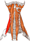 Gray — musculus scalenus anterior.png