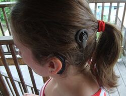 Cochlear implant2.jpg