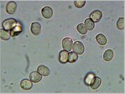 Pluteus cervinus spores.jpg
