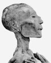 Ramses V mummy head.png
