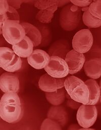 Lactococcus lactis, scanning electron micrograph.jpg