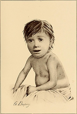 The diseases of infancy and childhood (1910) (14741111306).jpg