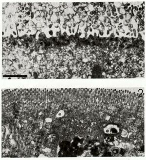 The micrograph at the top shows a damaged cell with a destroyed surface. The micrograph at the bottom shows a healthy cell with its surface intact.